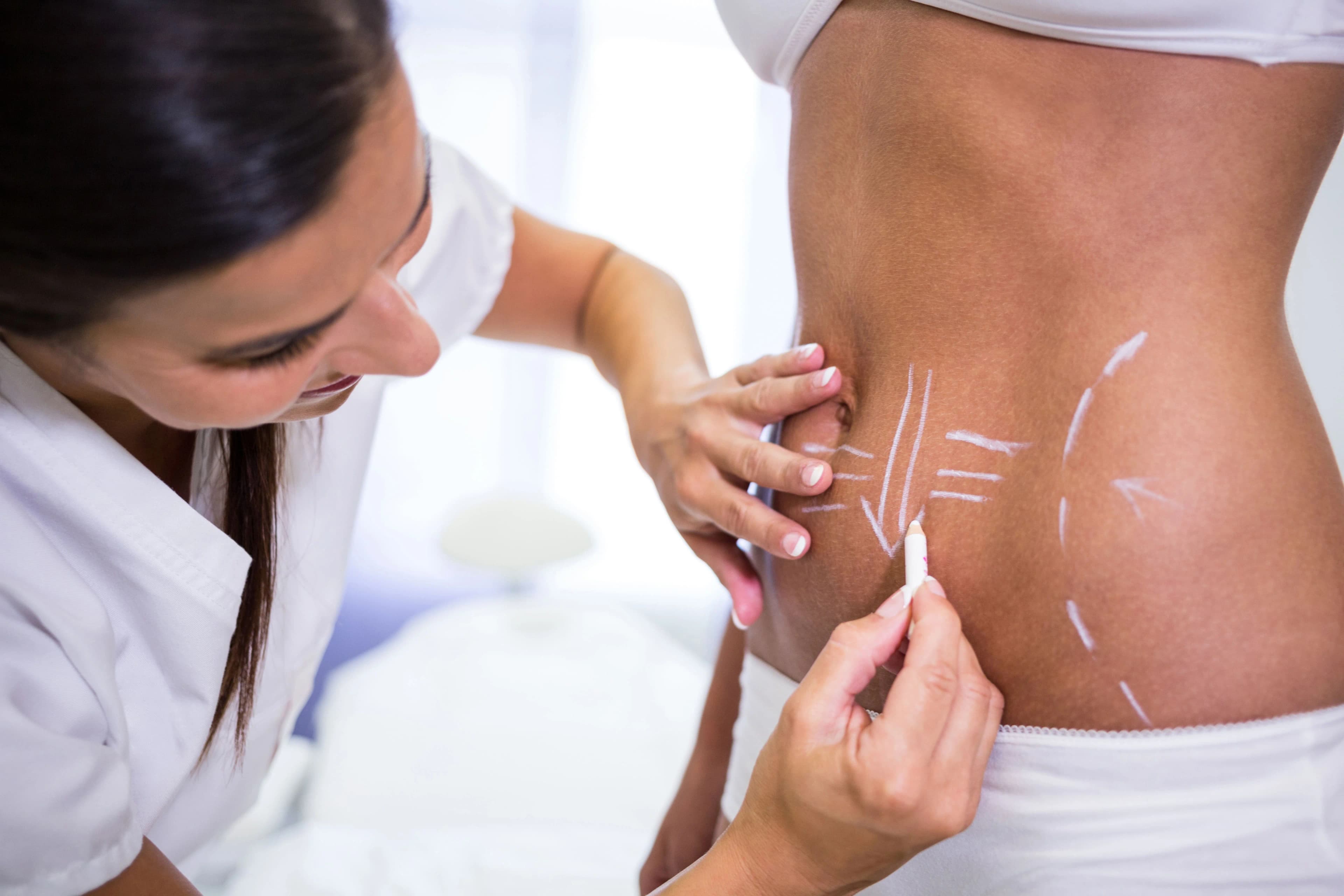 HIFU Body Contouring