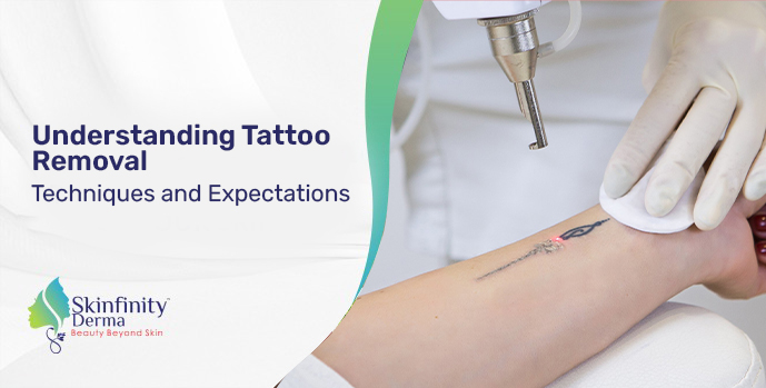 Say Goodbye to Your Unwanted Tattoo with PicoSure™ Laser Tattoo Removal -  Farrell Plastic Surgery P.C.