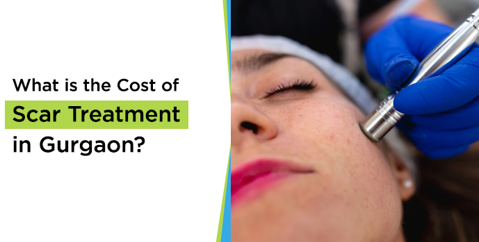  Cost of Scar Treatment in Gurgaon